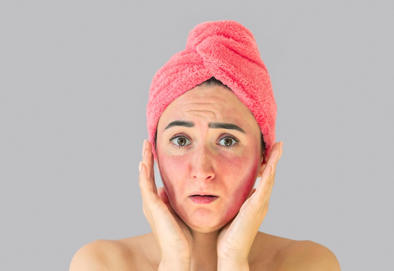 Tác dụng phụ của Tretinoin