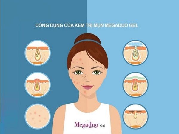 Công dụng của Megaduo gel