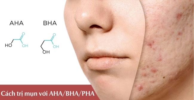 Trị mụn với AHA/BHA/PHA 