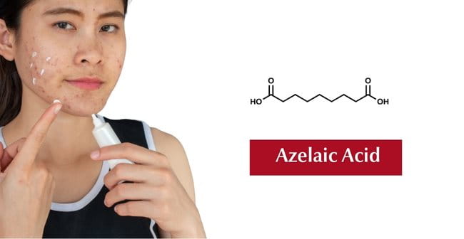 Trị thâm mụn với Axit Azelaic