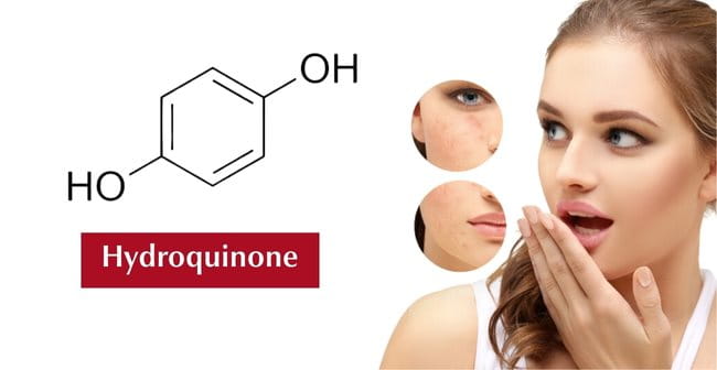 Trị thâm mụn bằng Hydroquinone