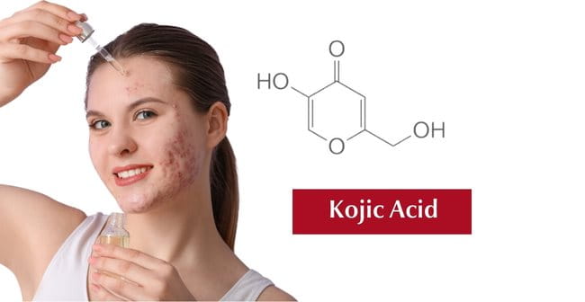 Trị thâm mụn với Kojic Acid