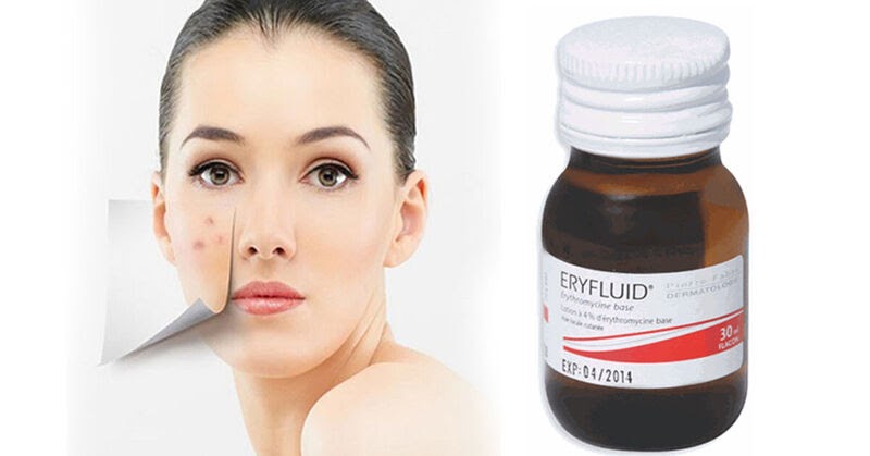 Thuốc trị mụn trứng cá Eryfluid